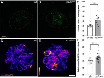 Influence of Mpv17 on Hair-Cell Mitochondrial Homeostasis, Synapse Integrity, and Vulnerability to Damage in the Zebrafish Lateral Line